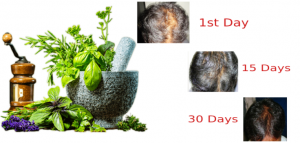 दिल्ली के डॉक्टर ने इस 1 अद्भुत तरकीब से सिर्फ 30 दिन में दोबारा उगाए अपने बाल