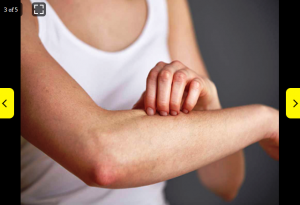 दाद-खाज-खुजली की समस्या से हैं परेशान, इस घरेलू नुस्खे से सात दिन में मिट जाएगा नामो-निशान