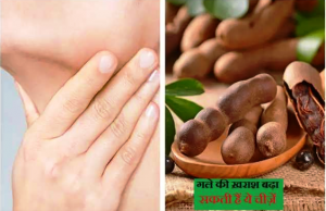 Sore Throat Cure: गले की खराश से परेशान हैं तो इन 7 चीज़ों से करें परहेज़