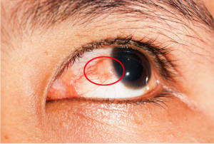 आंखों में दर्द, खुजली और जलन से हैं परेशान, तो अपनाएं ये 5 आसान टिप्स