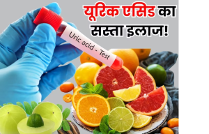 यूरिक एसिड का सबसे सस्ता और अच्छा इलाज, 5 खट्टी चीजों को डाइट में करें शामिल, 30 दिन में मिलेगा बेहतर रिजल्ट