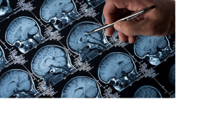 Screen Time: आंखों से लेकर मस्तिष्क तक को गंभीर क्षति पहुंचा रही है ये एक आदत, ब्रेन का साइज हो रहा है पतला