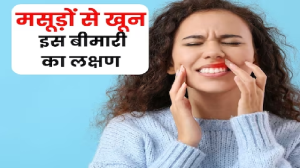 ब्रश करते वक्‍त दांतों से आता है खून, ना करें लापरवाही, तुरंत डेंटिस्‍ट से करें बात, हो सकता है इस बीमारी का लक्षण