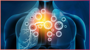 सांस की नली में इंफेक्शन हो जाए तो क्या करें? स्वामी रामदेव से जानें