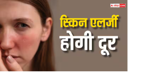 इन चीजों को डाइट में करें शामिल, स्किन एलर्जी रहेगी हमेशा दूर...कम दिनों में दिखेगा असर