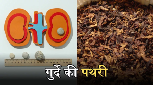Kidney Stone की वजह बन सकता है पान मसाला और प्रदूषित पानी, जानिए क्या कहते हैं एक्सपर्ट्स