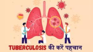 TB के 80% मरीजों में नहीं दिखता यह एक लक्षण, जानें क्या है ताजा स्टडी का दावा