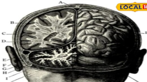 सिर में लगी चोट नजरअंदाज न करें, इसके लक्षण और इलाज के बारे में जानें