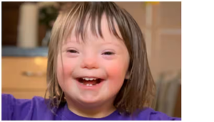 बच्चों की इन हरकतों पर दें ध्यान, हो सकता है डाउन सिंड्रोम का खतरा