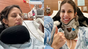 Migraine का इलाज कराना महिला को पड़ा भारी, बोटॉक्स इंजेक्शन लेने के बाद हुई जानलेवा बीमारी का शिकार