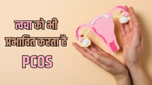 PCOS में सिर्फ मुंहासे ही नहीं ये समस्याएं भी पहुंचा सकती हैं आपकी त्वचा को नुकसान
