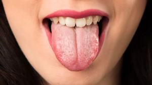 Benefits Of Cleaning Tongue: हेल्दी रहने के लिए सिर्फ दांत ही नहीं, जीभ की सफाई भी है जरूरी