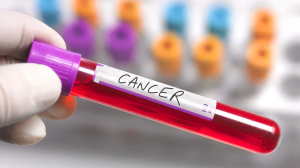 Blood Cancer : क्या एक से दूसरी जनरेशन में फैलता है ब्लड कैंसर? एक्सपर्ट्स से जानें