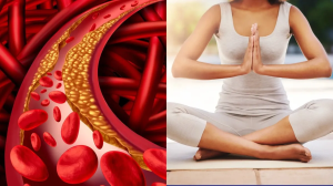 नसों में जमें बैड कोलेस्ट्रॉल को कम कर सकते हैं ये योगासन, दिल की सेहत भी होगी दुरुस्त