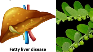 फैटी लिवर का काल हैं ये पत्ते और फल, इन आयुर्वेदिक औषधि से दूर करें लिवर की समस्याएं