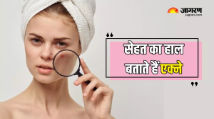 चेहरे पर होने वाले Acne करते हैं सेहत का हाल बयां, एक्सपर्ट से जानें किन समस्याओं की ओर करते हैं इशारा
