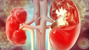 World Kidney Cancer Day 2024: किडनी कैंसर है साइलेंट किलर, हर साल इस बीमारी से लाखों लोगों की जाती है जान