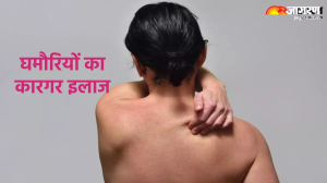Prickly Heat Remedies: घमौरियों ने कर रखा है बहुत ज्यादा परेशान, तो ये घरेलू उपाय दिलाएंगे इससे तुरंत आराम