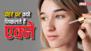 Face Mapping: 3,000 साल पुरानी पद्धति से करें चेहरे का इलाज, मुंहासों से मिलेगा झटपट निजात