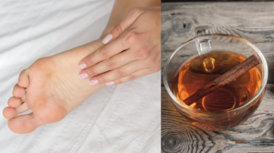 हाई यूरिक एसिड को कंट्रोल करने में दालचीनी का पानी है फायदेमंद; जानें कैसे करें सेवन?