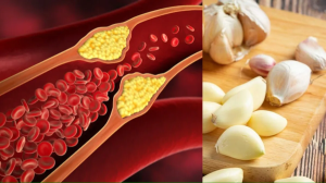 किचन में मौजूद ये तीन चीज़ें कर देती हैं Bad Cholesterol का सफाया, खून से LDL हो जाता है फ़िल्टर; डाइट में करें शुमार