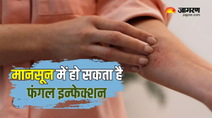 सिर्फ डेंगू ही नहीं, मानसून में Fungal Infection का भी बढ़ जाता है खतरा, इन तरीकों से रखें अपना ख्याल