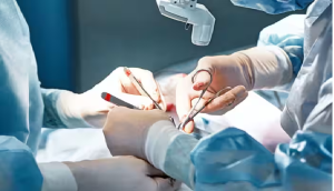 अब बिगड़े चेहरे को मिलेगी नई पहचान, AIIMS जल्द शुरू करेगा फेस ट्रांसप्लांट, जानिए कौन ले सकता लाभ