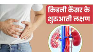 किडनी कैंसर के शुरुआती स्टेज में शरीर में नजर आते हैं ये 5 लक्षण, समय पर पहचानकर कराएं इलाज