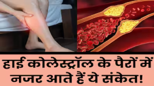 कोलेस्ट्रॉल बढ़ने पर पैरों में दिखाई देते हैं ये 5 लक्षण, 90 फीसदी लोग साधारण समझकर करते हैं इग्नोर