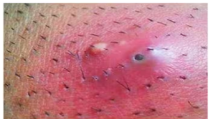 स्किन के छोटे बाल बन सकते हैं इस बड़ी बीमारी का कारण, ये लक्षण दिखने पर तुरंत हो जाएं सतर्क