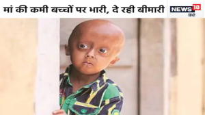 प्रेग्‍नेंसी में एक गलती से बच्‍चों के ब्रेन में हो रही खतरनाक दिक्‍कत, करवाना पड़ सकता है अबॉर्शन, डॉ. ने दी सलाह