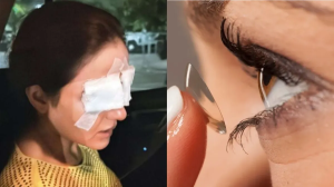 कॉन्टैक्ट लेंस लगाने से टीवी एक्ट्रेस जैस्मिन भसीन को दिखना हुआ बंद, डॉक्टर से जानें आंखों के लिए कब हानिकारक हो जाते हैं लेंस?