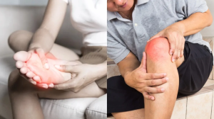 हाई यूरिक एसिड बढ़ने पर हड्डियां लगती हैं चटकने, बढ़ जाता है इन गंभीर बीमारियों का खतरा; जानें कैसे करें बचाव?