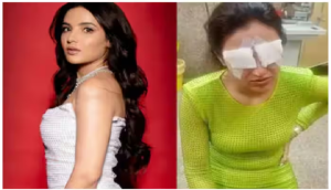 जैस्मीन भसीन को लेंस पहनना पड़ा भारी, कॉर्निया डैमेज का शिकार हुईं एक्ट्रेस, कहीं आप भी तो नहीं कर रहे ये गलती?