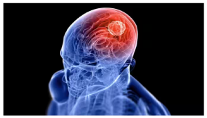 इस कैंसर की चपेट में ज्यादा आते हैं वयस्क, ये लक्षण दिखने पर हो जाएं सावधान