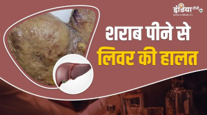 शराब पीने से ऐसी हो जाती है लिवर की हालत, डॉक्टर ने दिखाई डरा देने वाली तस्वीर, हो जाएं सावधान